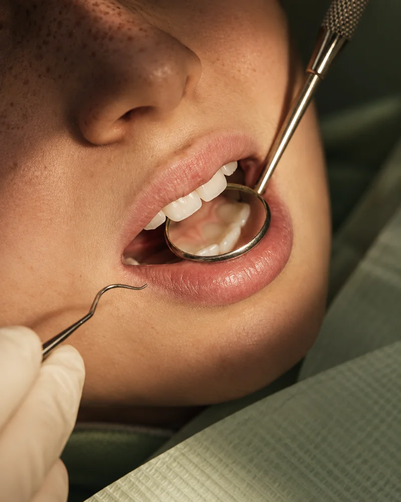 Fictional warm-lit dental examination with a mirror and gloved hand
